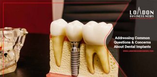 common-dental-implant-questions-answered